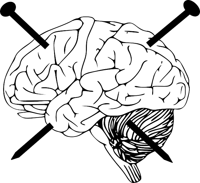 Hoy mi cerebro no funciona
